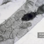 کنه تراشه آکاراپیس