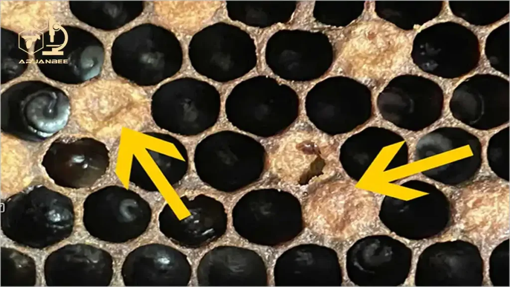 درپوش های فرو رفته سلول مولدین . بیمار