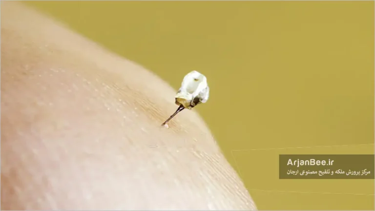 نیش زنبور عسل