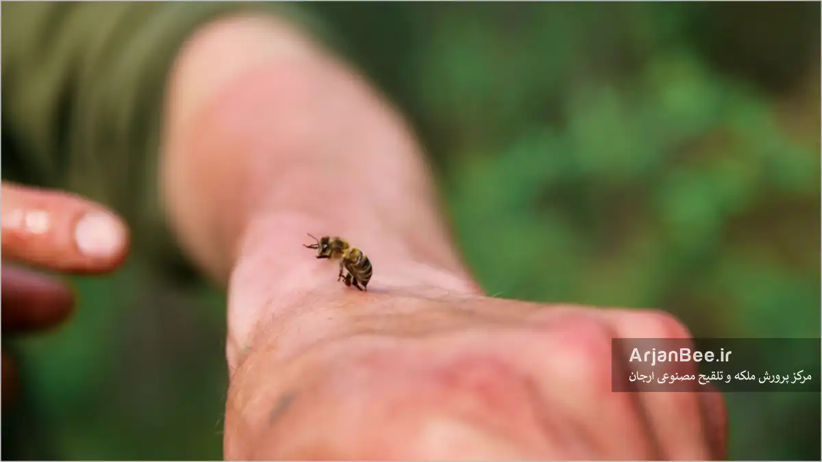 نیش زنبور عسل