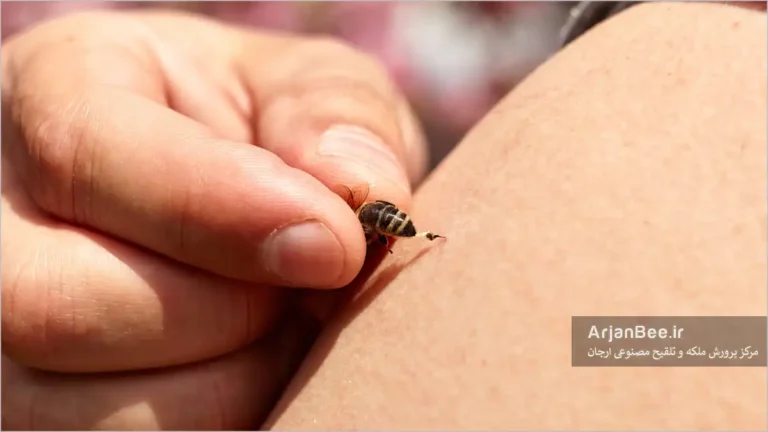 زنبور درمانی