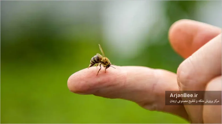 نیش زدگی زنبور عسل