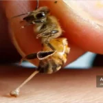 نیش زنیور عسل