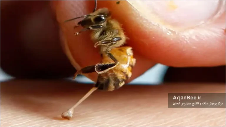 نیش زنیور عسل